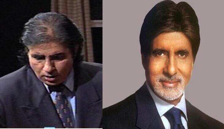 Bollywood Celebs who have Undergone Hair Transplants or Wear a Wig