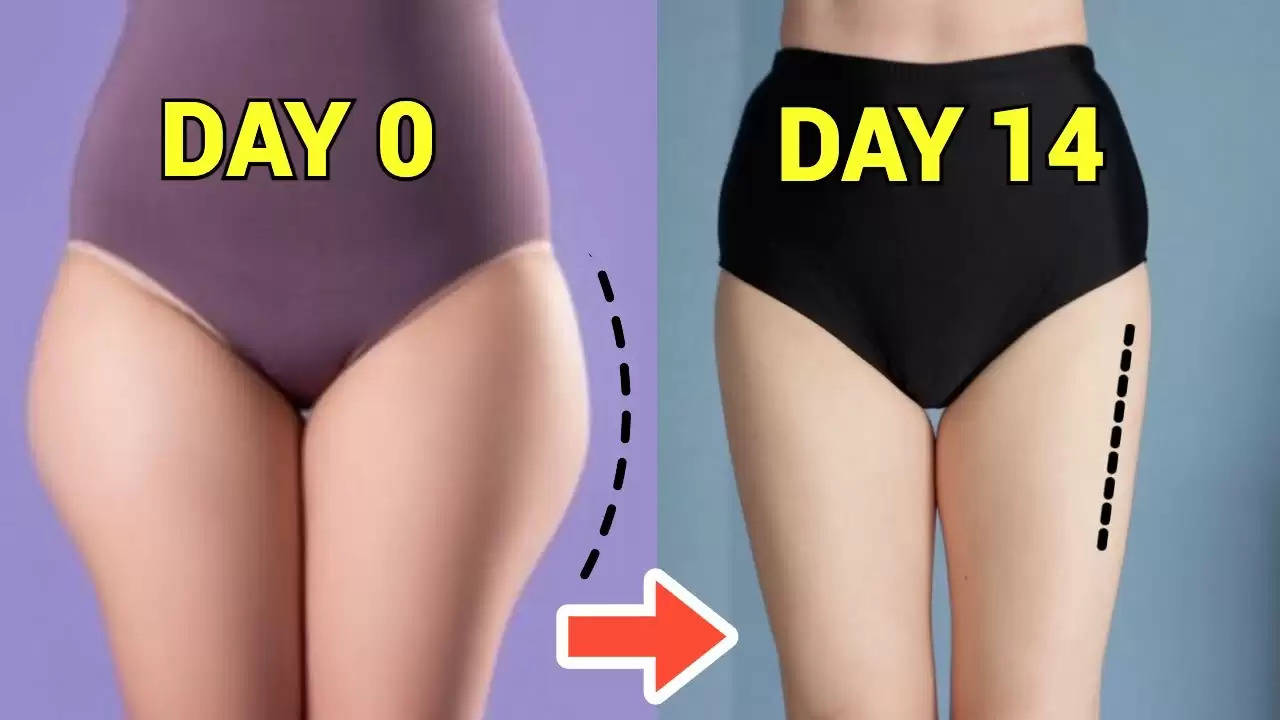 What Are Saddlebags Or Outer Thigh Fat