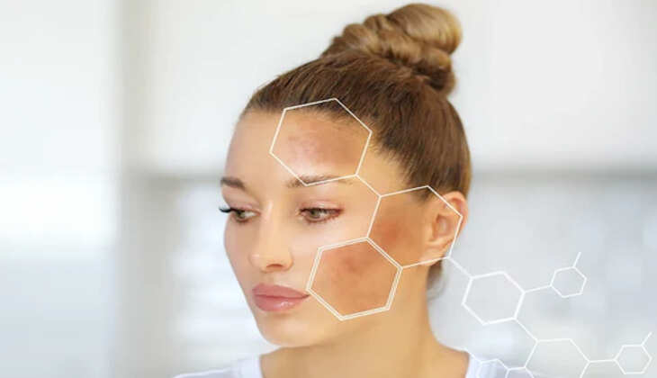 Glow Sunscreen: The Key to Combatting Hyperpigmentation