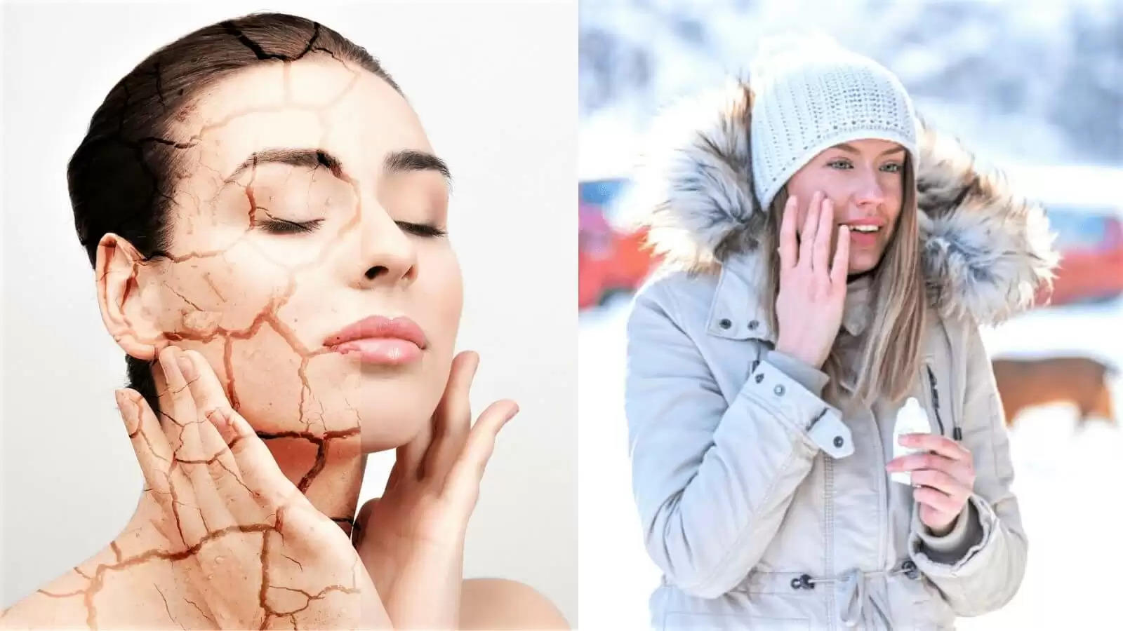 winter skin care 