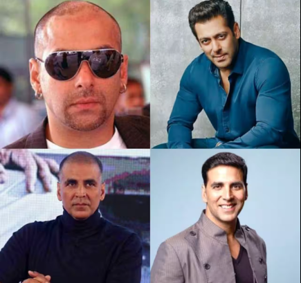 12 Bollywood Celebs Before And After Hair Transplantation  YouTube