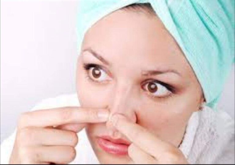 How To Remove Black Heads