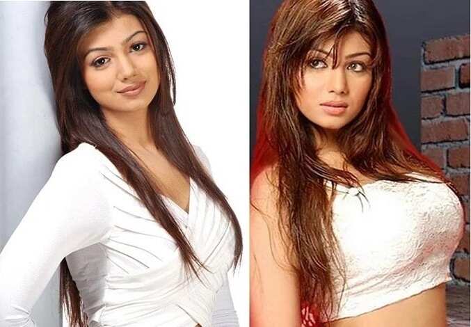 7 Bollywood Actresses Who Went For Breast Implants
