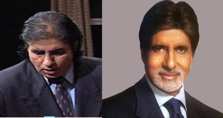 Bollywood Celebs who have Undergone Hair Transplants or Wear a Wig