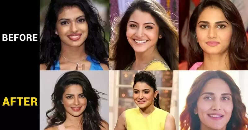 List Of Bollywood Actresses Who Have Undergone Plastic Surgery Till 2021