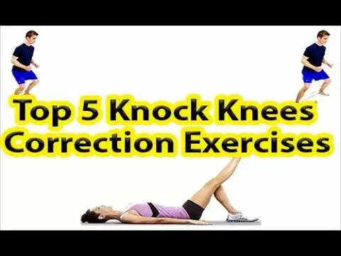 5 Best exercises to correct knock knees