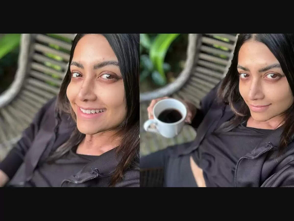 Actress Mamata Mohandas Was Diagnosed With An Autoimmune Disease Following Samantha Ruth Prabhu