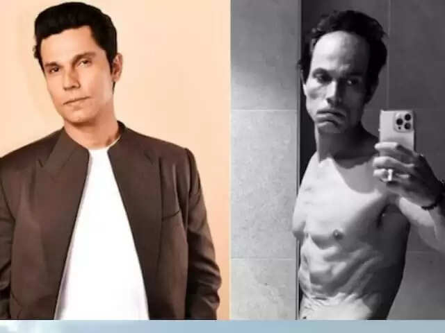 Randeep Hooda Shared His Near-Death Experience While Underwent Extreme Weight Loss For Swatantrya Veer Savarkar!!!