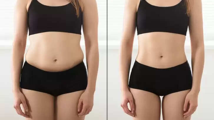 Know About Liposuction, Non Invasive & Non Surgical Laser Lipo