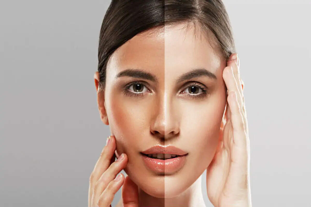 Know About Skin Lightening & Skin Whitening Treatment