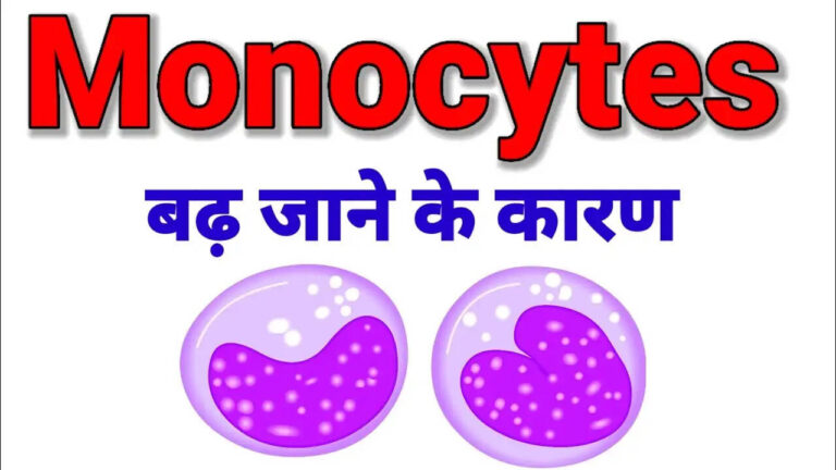 मोनोसाइटोसिस क्या है? कारण, लक्षण और इलाज? What is Monocytosis Explained in Hindi