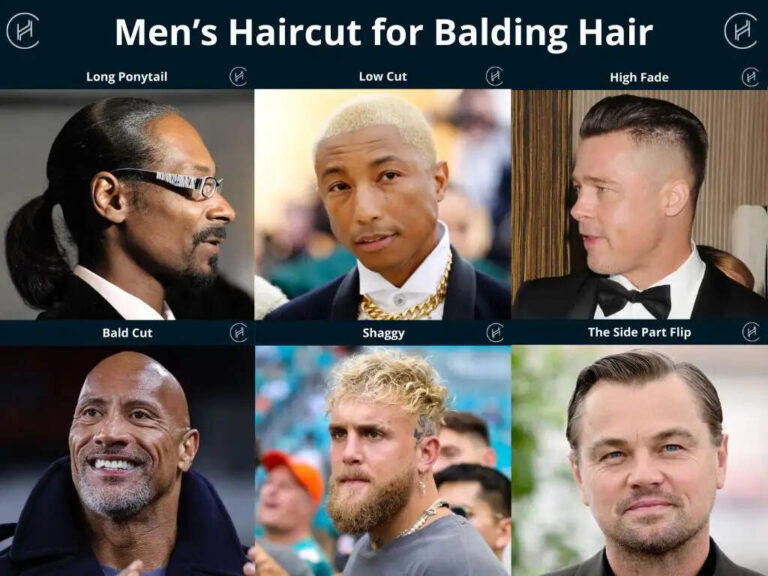 Top 10 Hairstyles For Balding Men In 2025