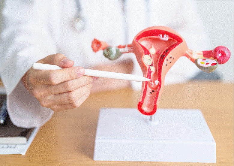 From Bloating to Back Pain: Hidden Symptoms of Ovarian Cancer