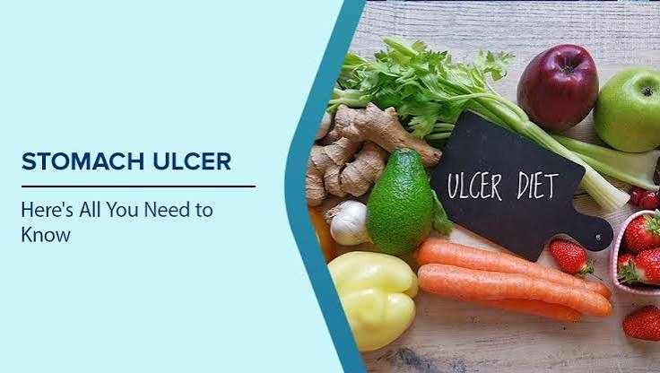Stomach Ulcer Diet